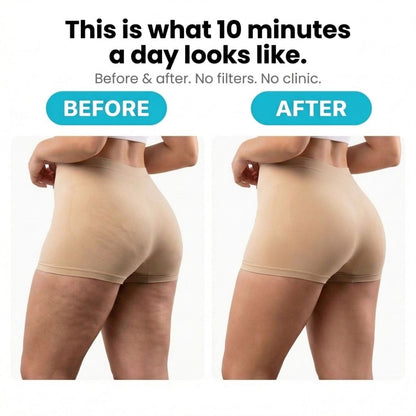 Orthonod™ - Anti-Cellulite Rotating Massager